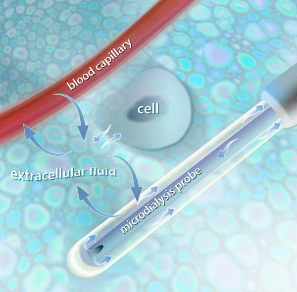 The microdialysis catheter mimics a “blood capillary”. There is an exchange of substances via extracellular fluid.