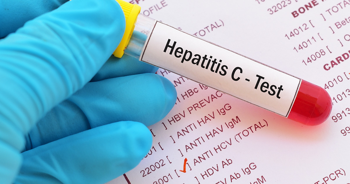 The Push to Eliminate Hepatitis C | RUSH