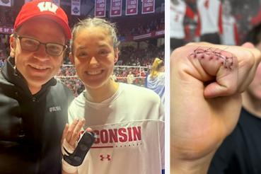 Dr. Tueting and patient Caroline and close-up of her injured finger