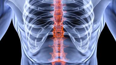 5 Spinal Fusion Facts | Rush System